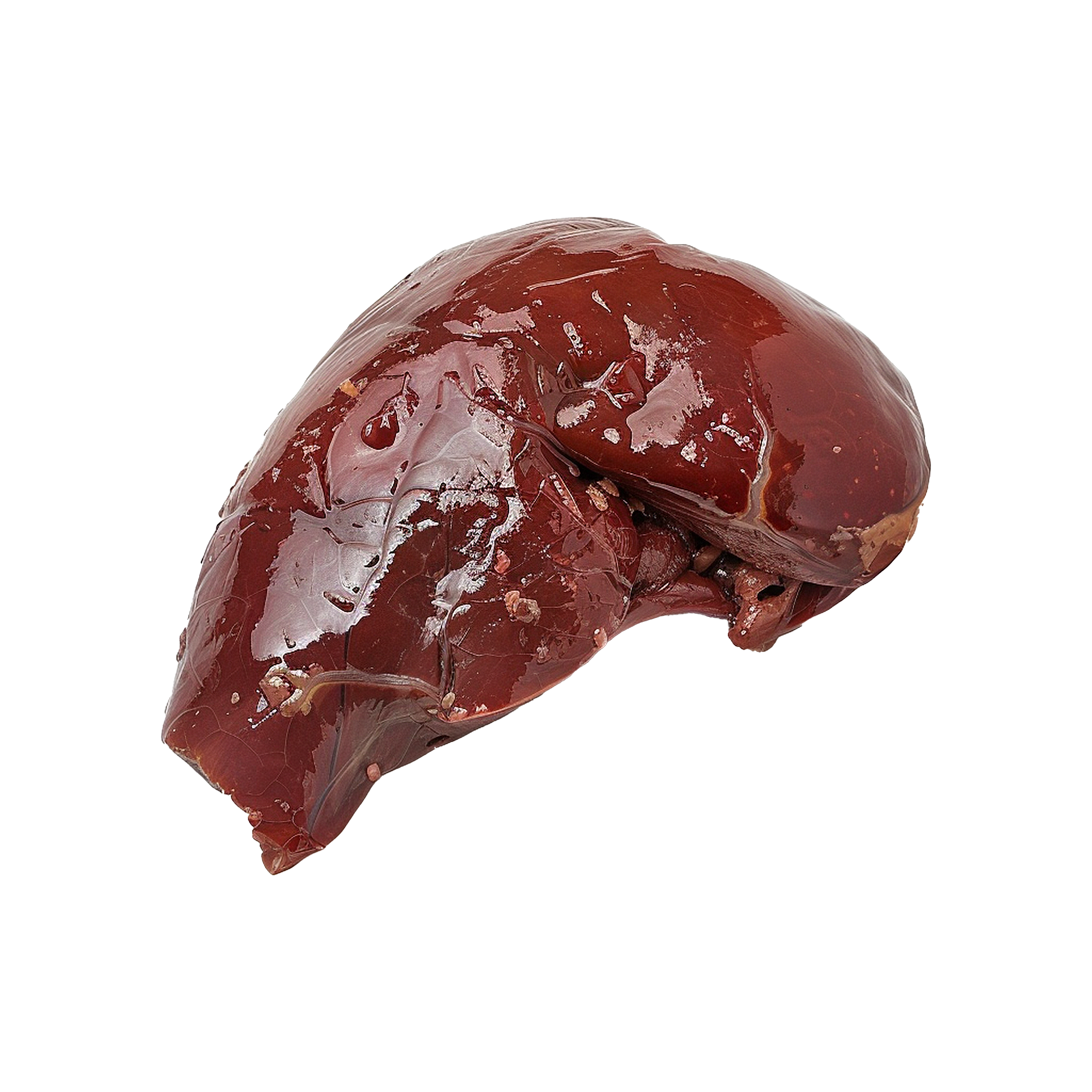 Liver